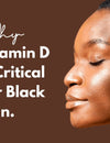 The Vitamin D Crisis In Black Skin
